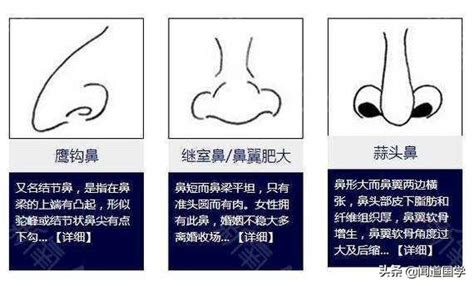 陰溝鼻|陰溝鼻子的人為人怎樣 面相解析